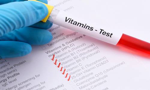 Vitamin test image