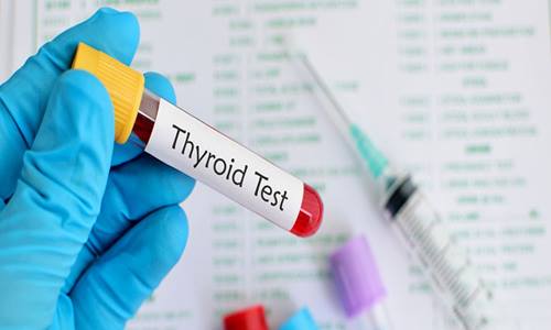 thyroid test image